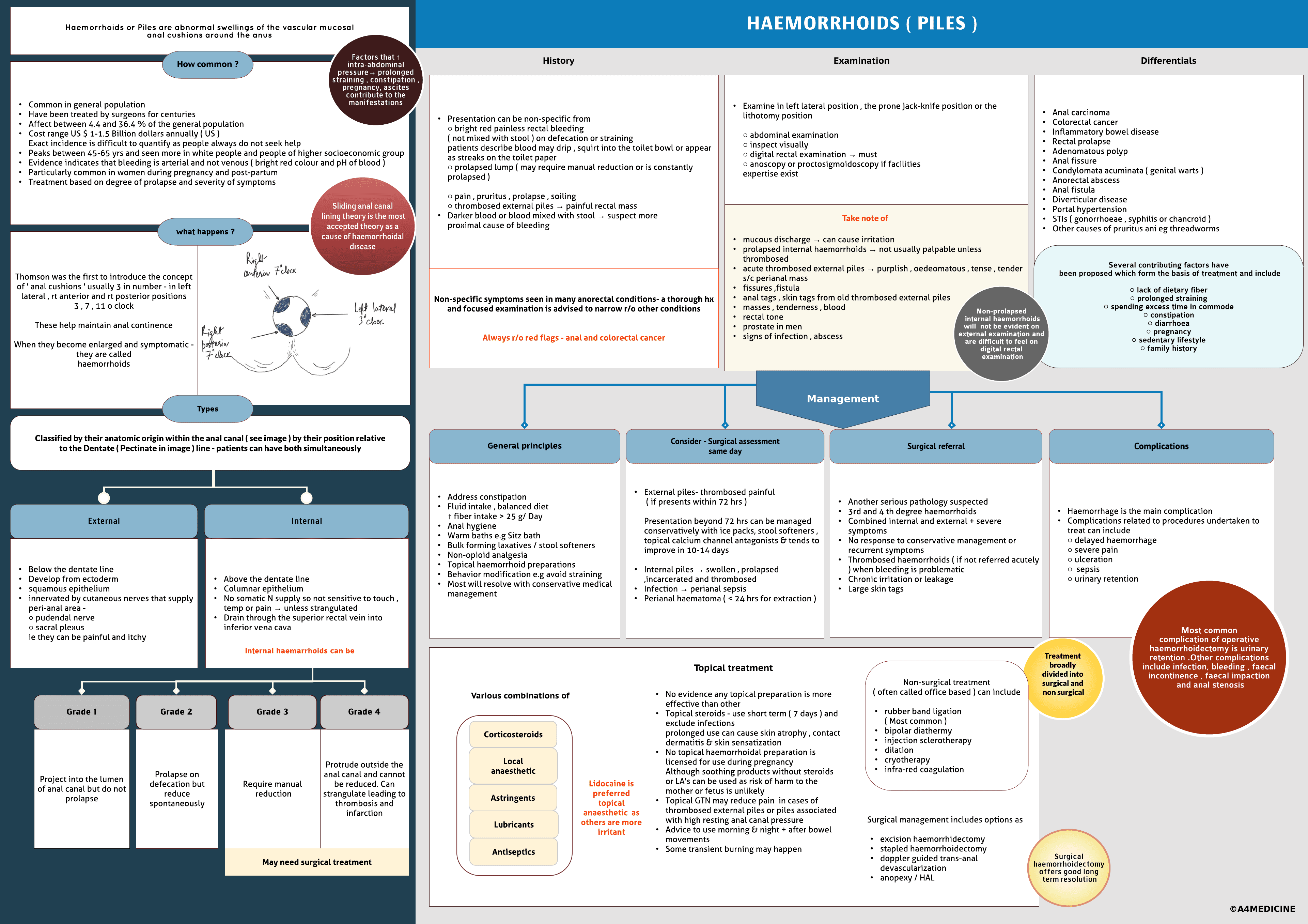 Haemorrhoids ( Piles )