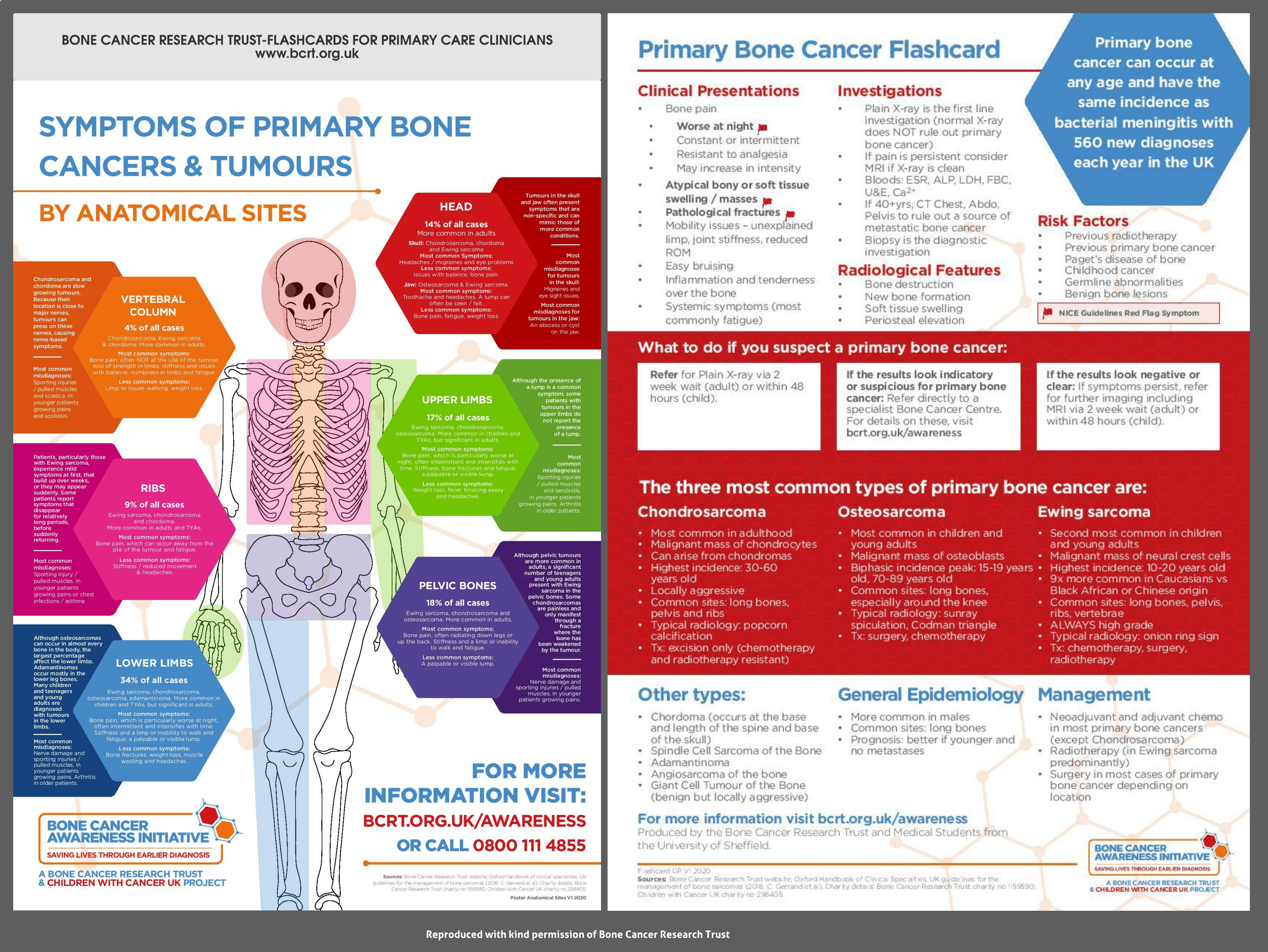 Primary Bone Cancer – Posters from Bone Cancer Research Trust