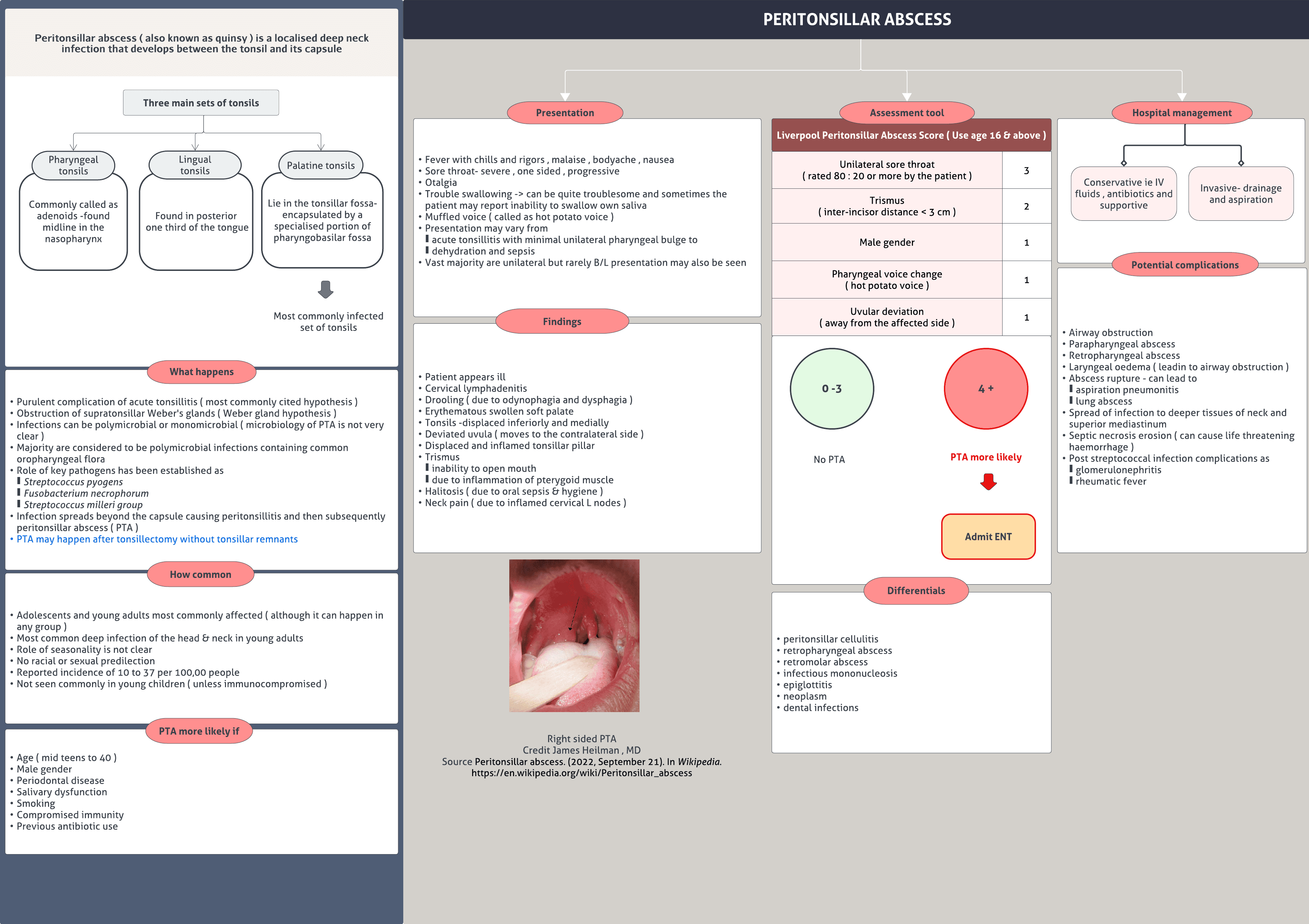 Peritonsillar abscess