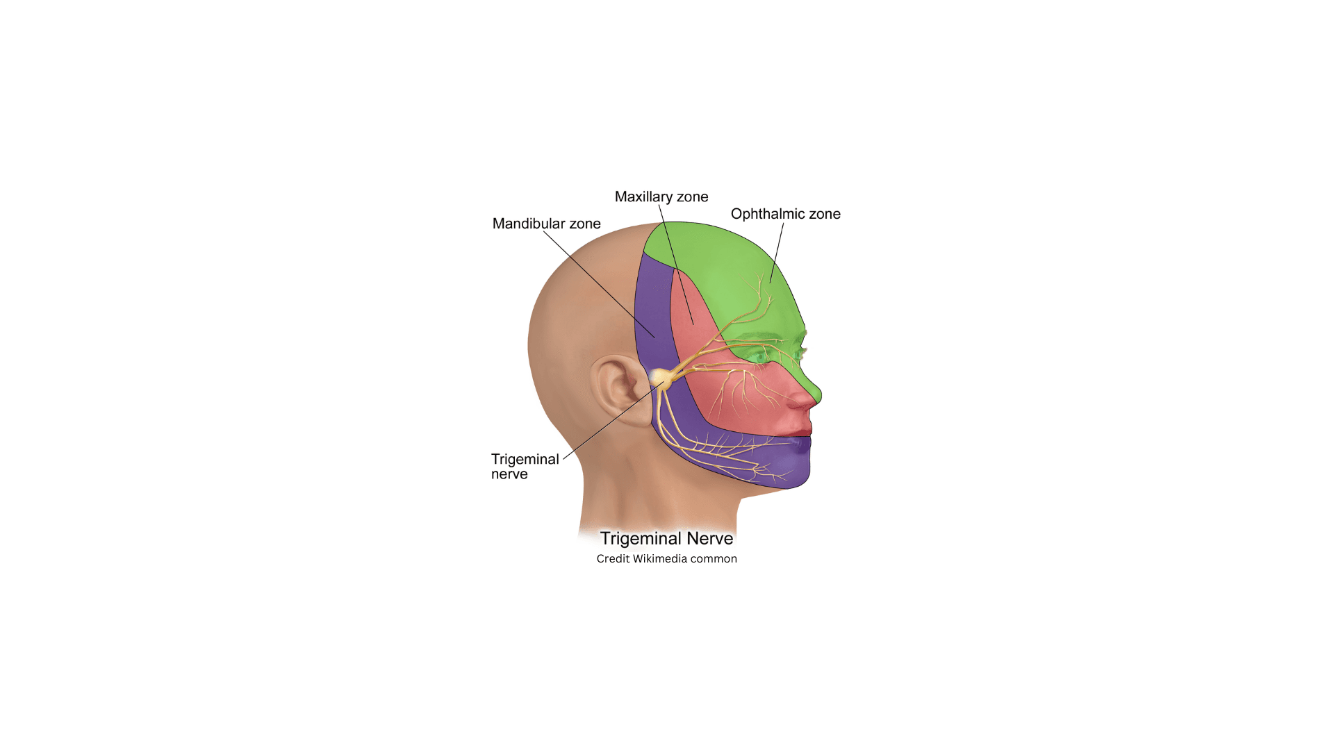 Trigeminal neuralgia : presentation and assessment