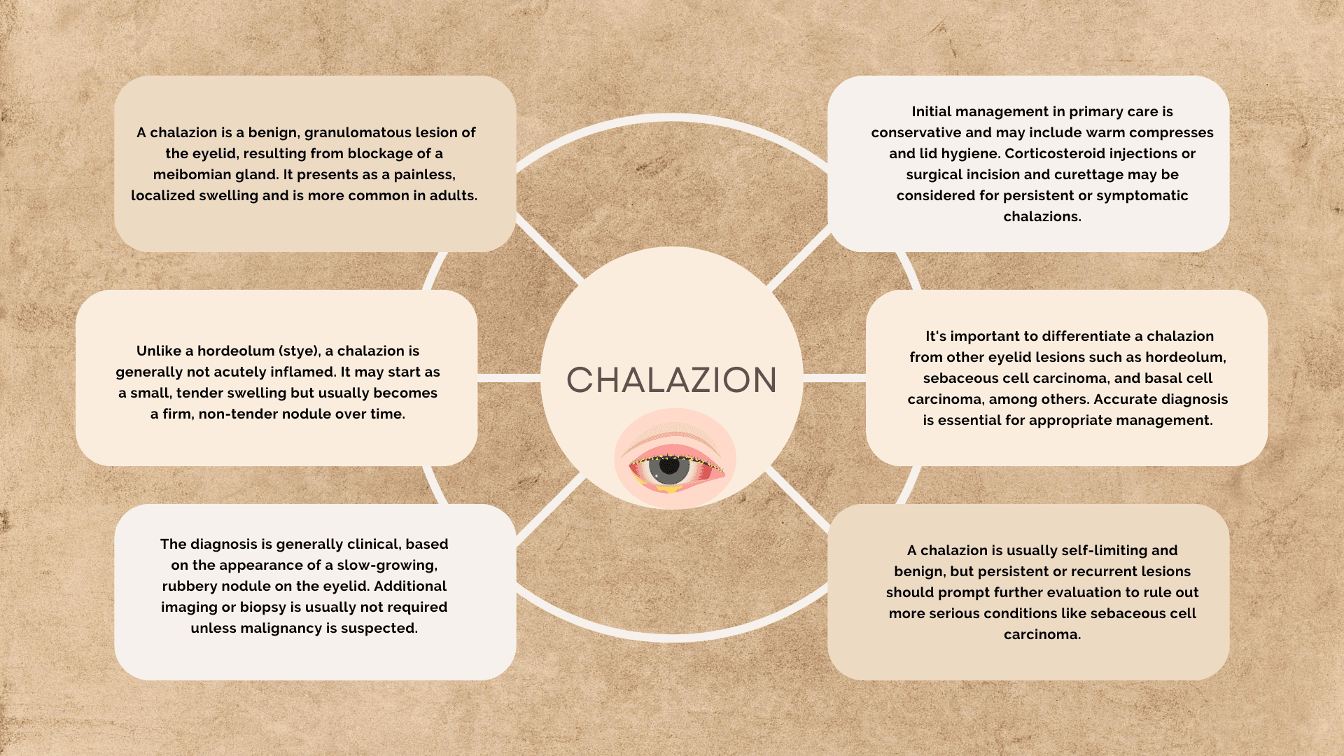 Chalazion ( Meibomian cyst )